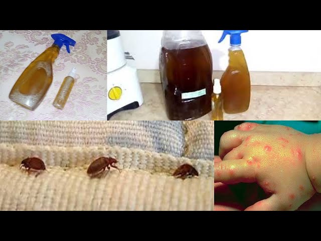 شركة مكافحة حشرات الفراش في صبيا